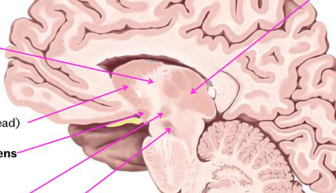 <p>Can you label this parasagittal veiw of the brain?</p>