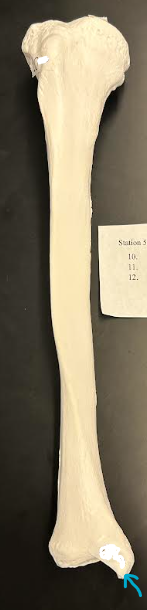 <p>ID tibia structure</p>
