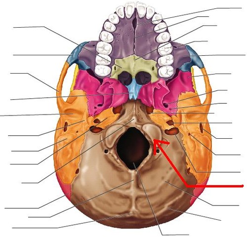 term image