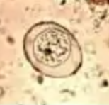 <p>Identify</p>