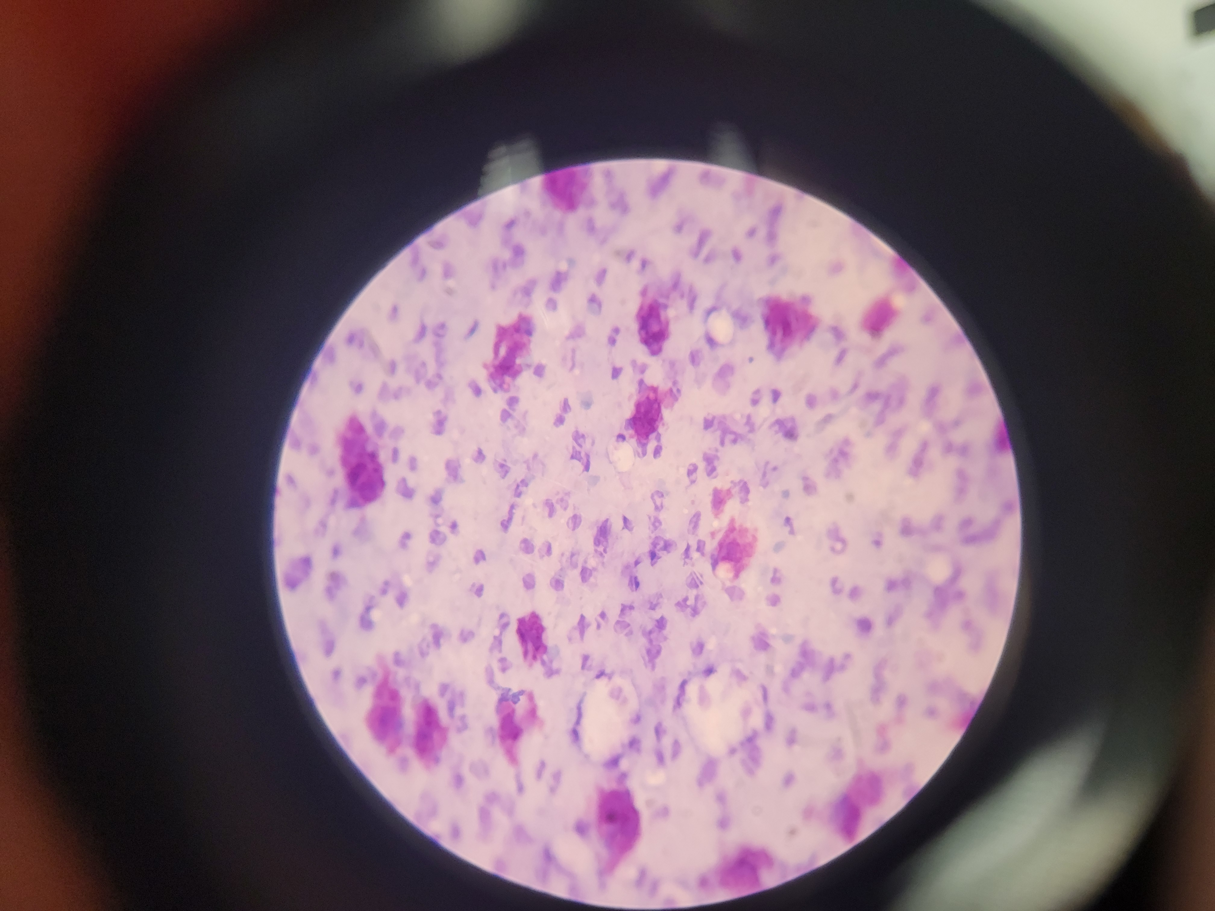 <p>What is shown? What 2 things are featured in this image?</p>