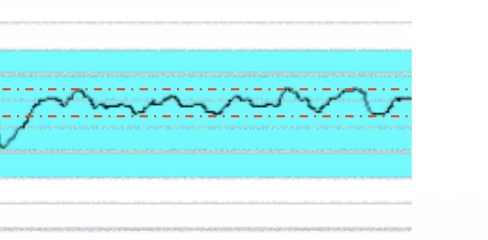 <p>this is what type of variability </p>