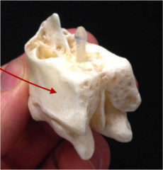 <p>Medial wall , flat surfaces, smooth (structure)</p>