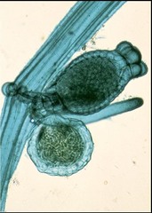 <p>Domain: Eukarya</p><p>Phylum: Chlorophyta (Green algae)</p><p>Kingdom: Protista</p><p>Class: Charophyceae</p><p>Genus: /Chara/</p><p>Form: Multicellular</p><p>Life Cycle: Zygotic</p><p>Structures: </p><p> - Whorled branches</p>