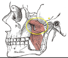 <p>mandible (neck of condyle)</p>