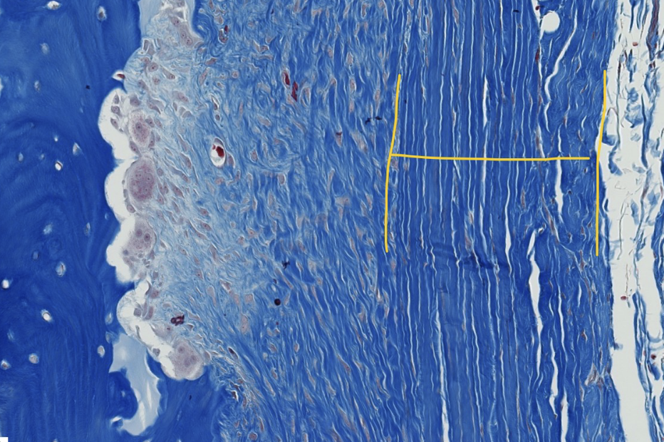 <p>in actively growing bone, the periosteum has 2 visible layers. ID the yellow bracketed layer</p>