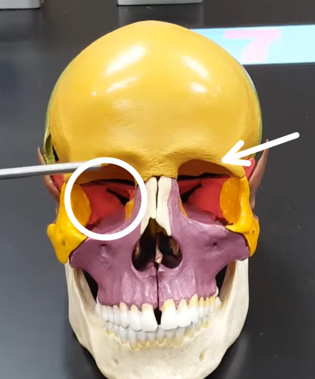 term image
