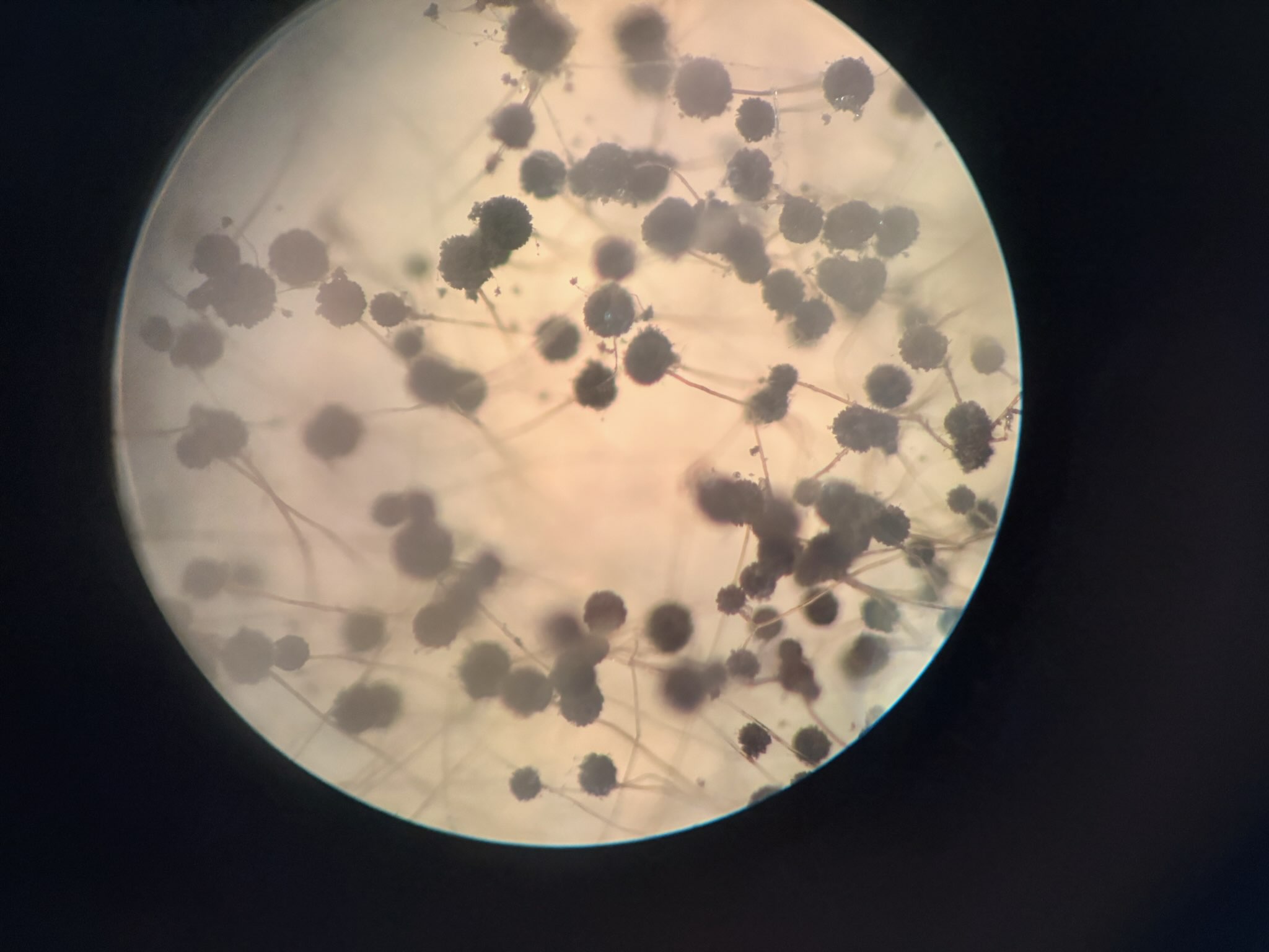 <p>*What fungus is this</p>