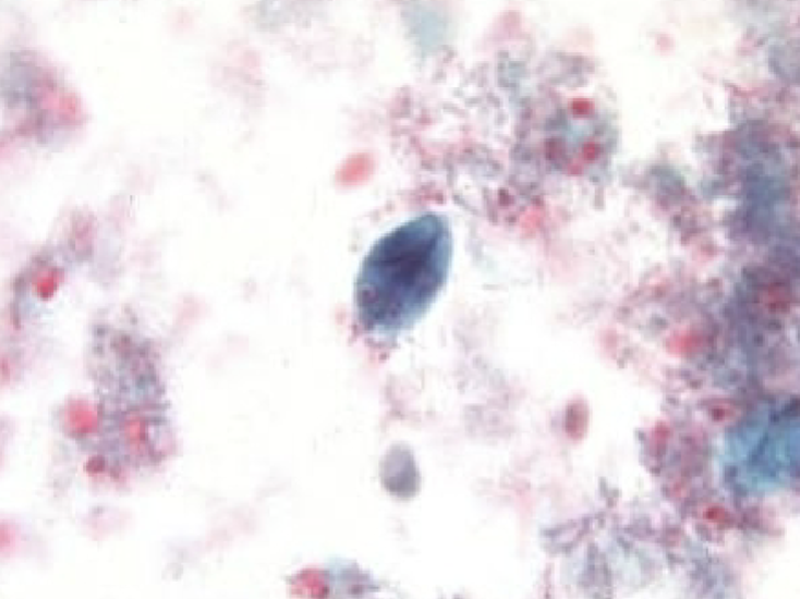 <p>What protist/cyst is this?</p>
