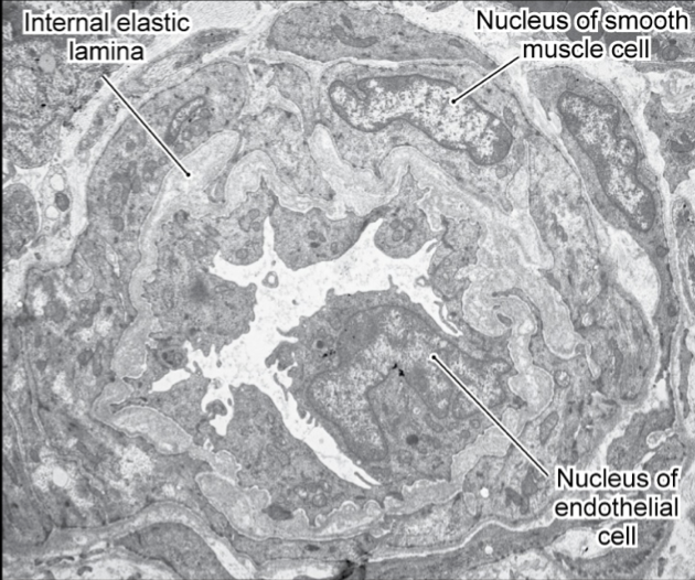 <p>arteriole</p>