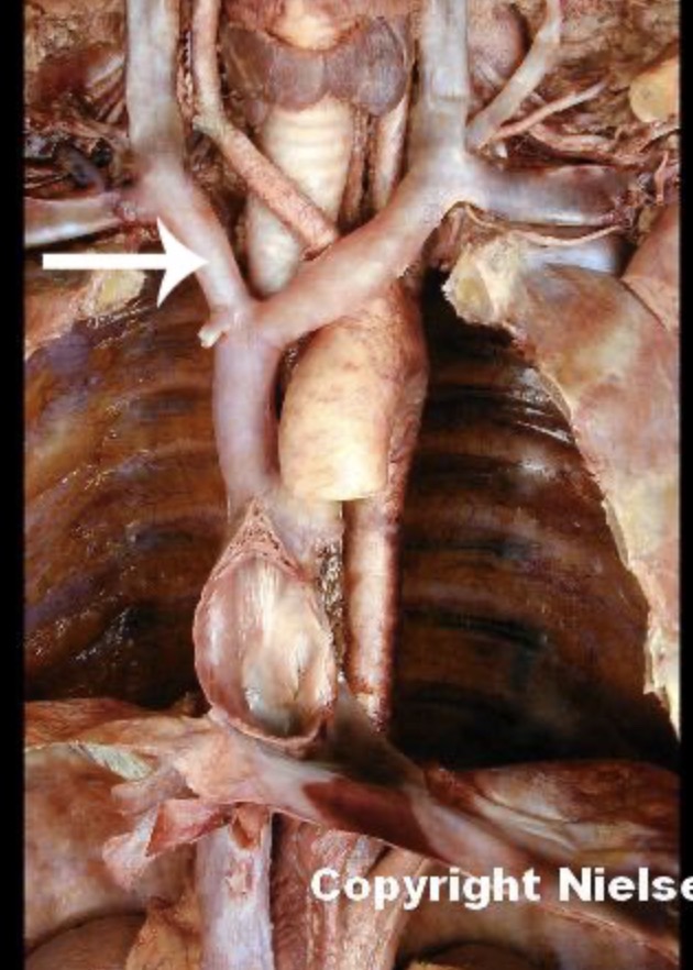 <p>The indicated vessel is the _</p>