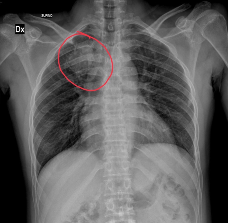 <p>40 yr old male is wheezing and coughing</p>