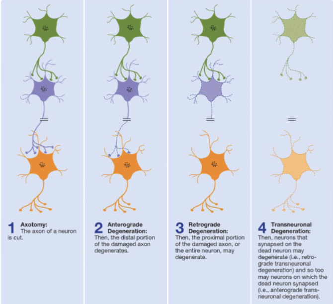 <p><span style="background-color: inherit; line-height: 19.55px; color: windowtext;">Axons and dendrites of damaged neuron break down</span><span style="line-height: 19.55px; color: windowtext;">&nbsp;</span></p>