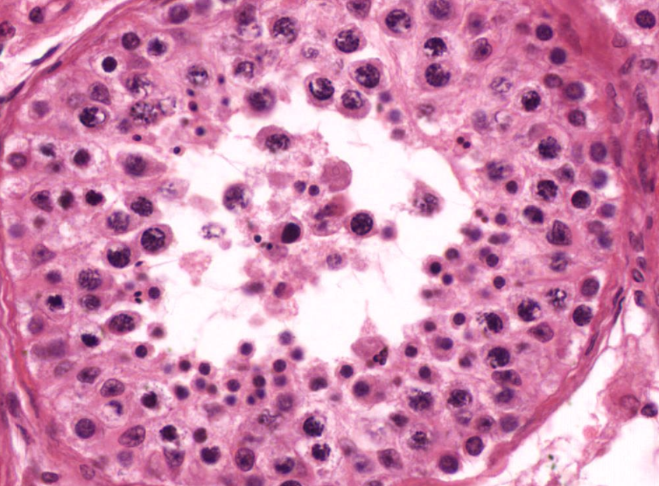 <p>Primary Spermatocytes</p>