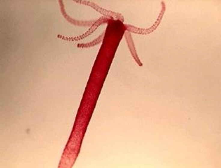 <p>phylum: cnidaria</p>