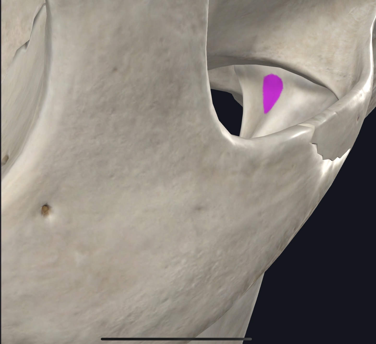 <p>Superior head: joint capsule and articular disc of TMJ; Inferior head: pterygoid fovea on anteromedial aspect of neck of condyloid process of mandible</p>