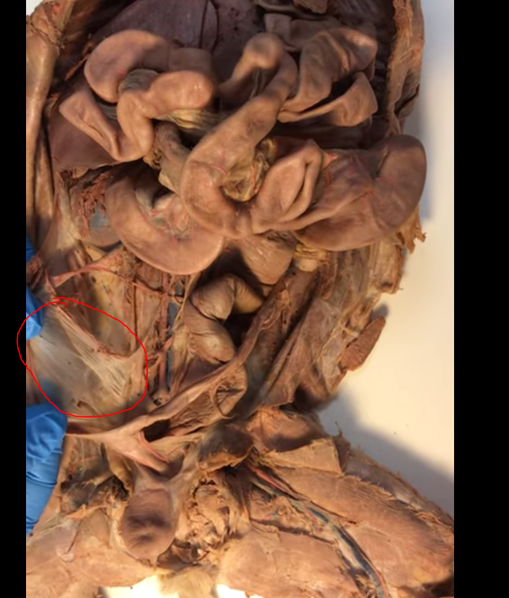 <p>What is this structure</p>