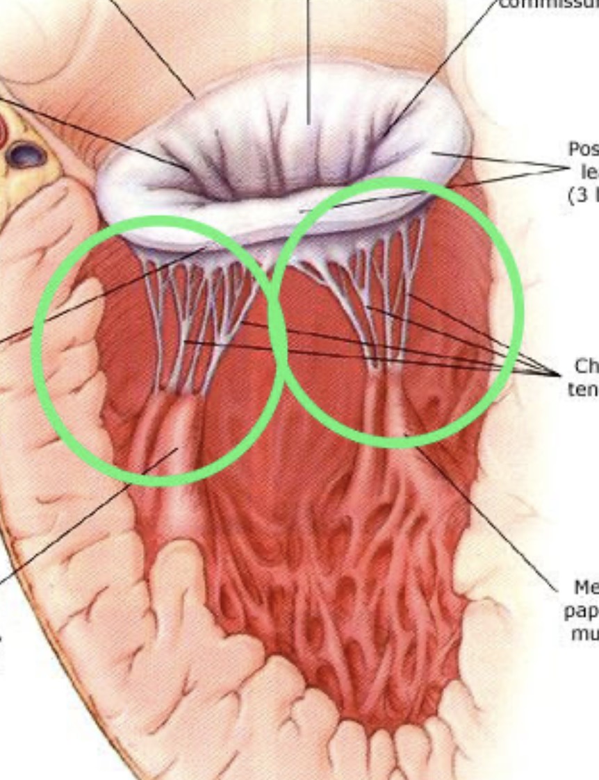 <p><span><span>thin, strong cords that connect the atrioventricular (tricuspid and mitral) valve leaflets to the papillary muscles, preventing valve prolapse during ventricular contraction.</span></span></p>