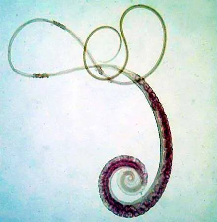 <p>Whipworm</p>