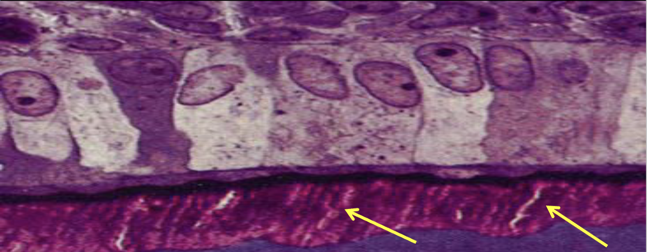 term image
