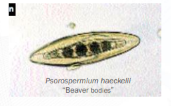 <p>Beaver Bodies</p>