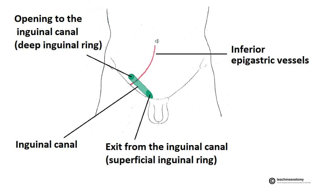 <p>superficial [external] inguinal ring</p>