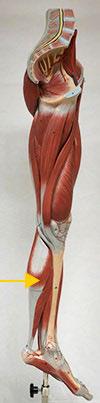 <p>Gastrocnemius</p>