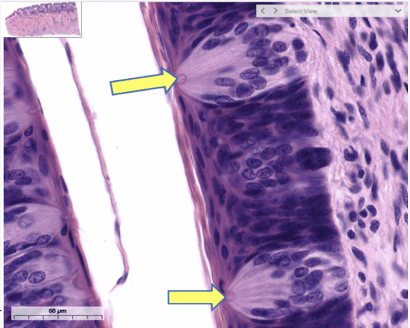 <p>Identify the following structure</p>