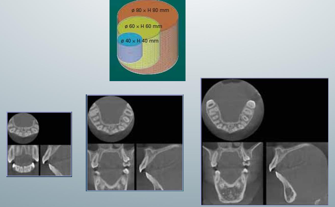 <p>-field-of-view</p><p>-anatomical area included in the volume</p><p>-consider the balance between dose savings and best image quality</p>