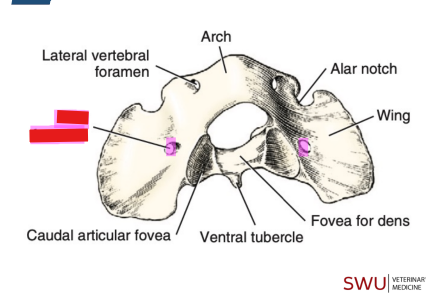 <p>Q: On the atlas, the vein extends through the …… caudally. </p><p>A. Lateral vertebral foramen </p><p>B. Alar foramen </p><p>C. Alar notch </p><p>D. Transverse foramen</p>