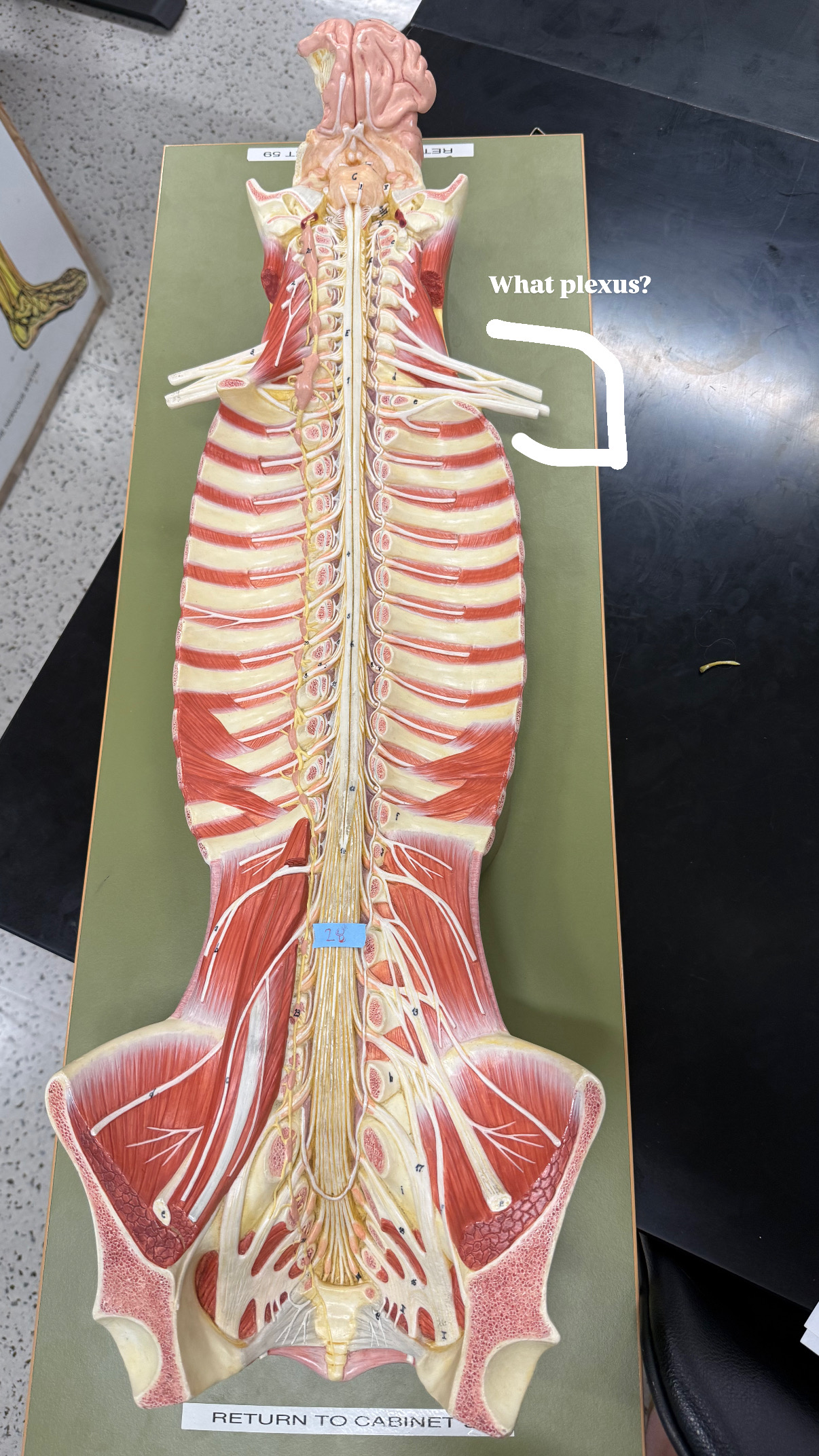 <p>bunch of nerves connected, bunched up, plexus</p>