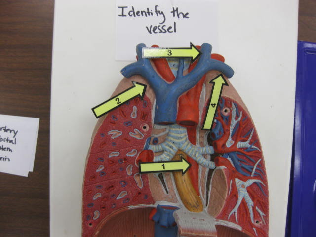 <p>Identify The Vessel 1, 2, 3 and 4?</p><p>Lab Image 3-5</p>