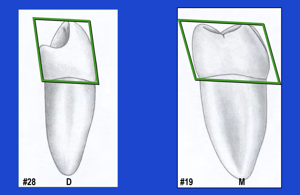 <p>Rhomboidal</p>