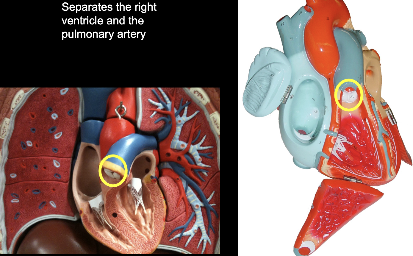 <p>what part of the heart muscle is shown?</p>
