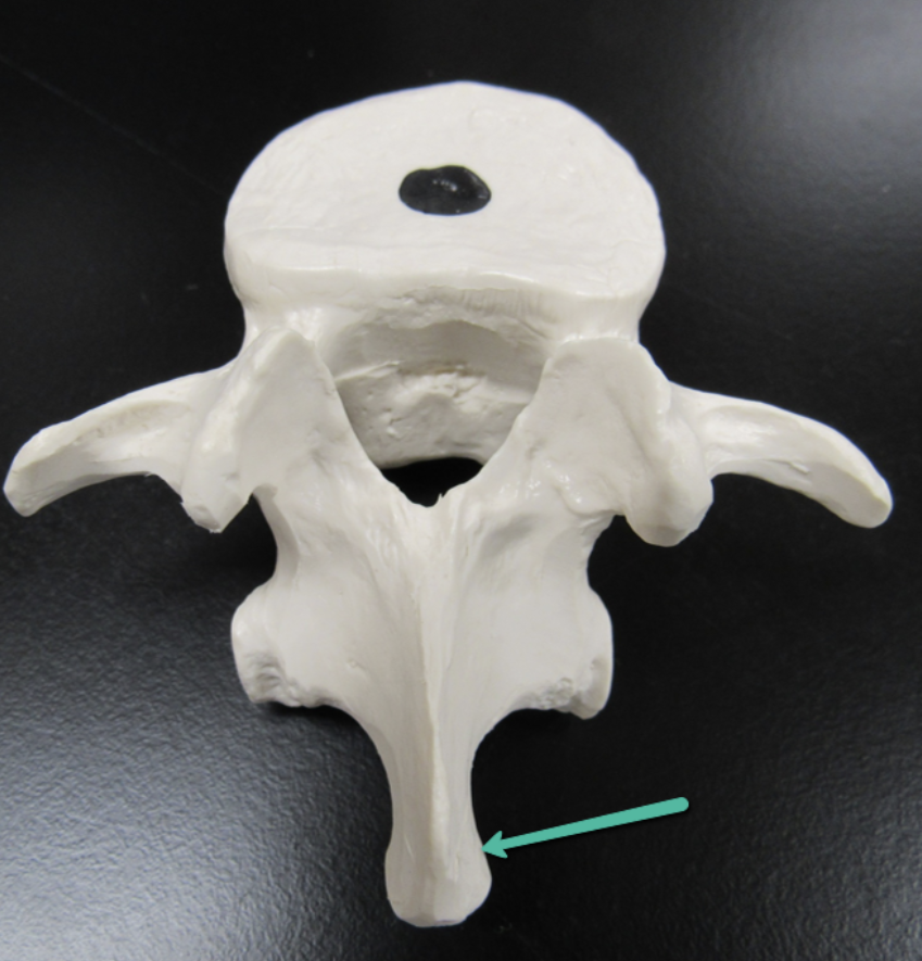 <p><span><strong>Identify the bone marking indicated by the pointer.</strong></span></p>