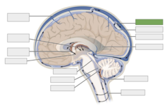<p>This is the</p>