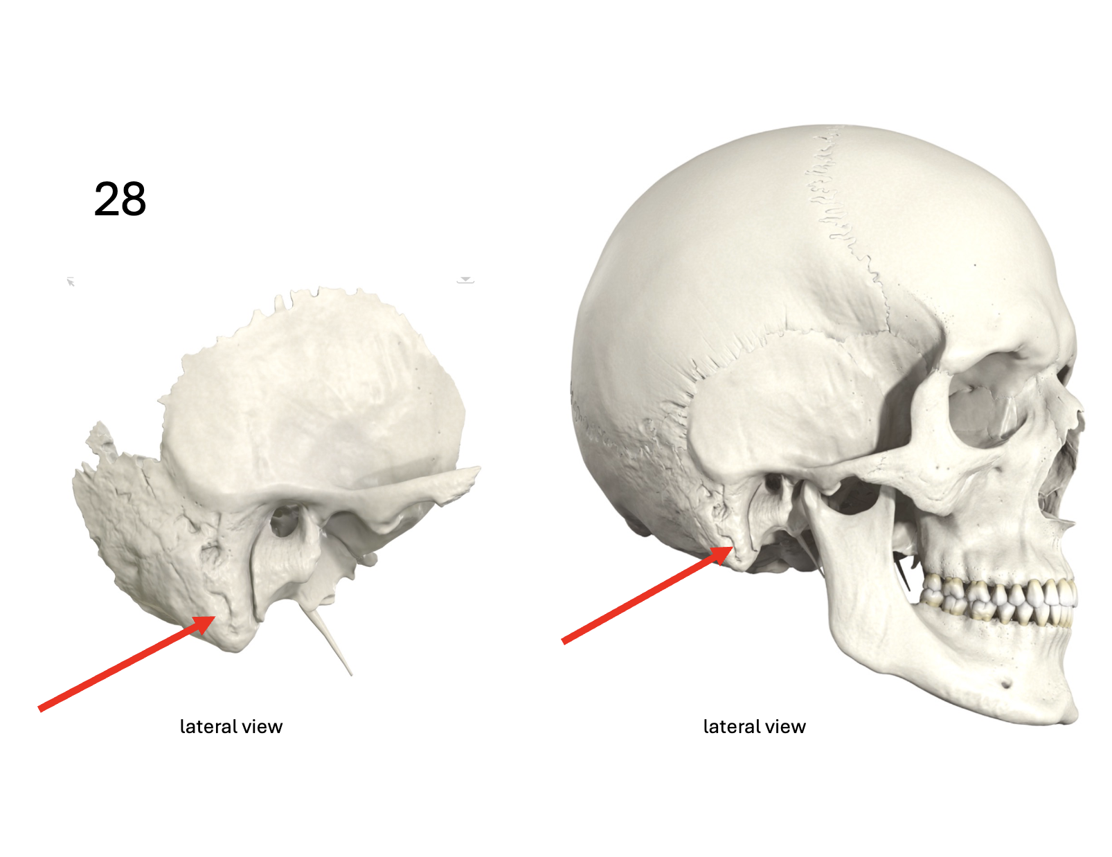 <p>Identify the <strong>bone and landmark</strong></p>