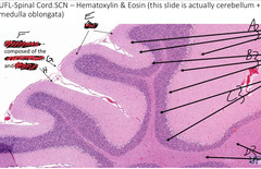 <p>What is indicated by the arrows 'D' in this slide of cerebellum and medulla?</p>