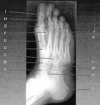 <p>J</p>