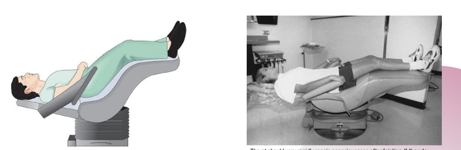 <p><strong>Complication</strong> – At some point during the process of administering local anesthetic (before, during, or after) your pt complains of lightheadedness and faints</p>