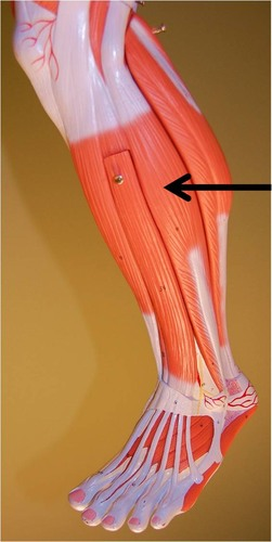 <p>What muscle is this?</p>
