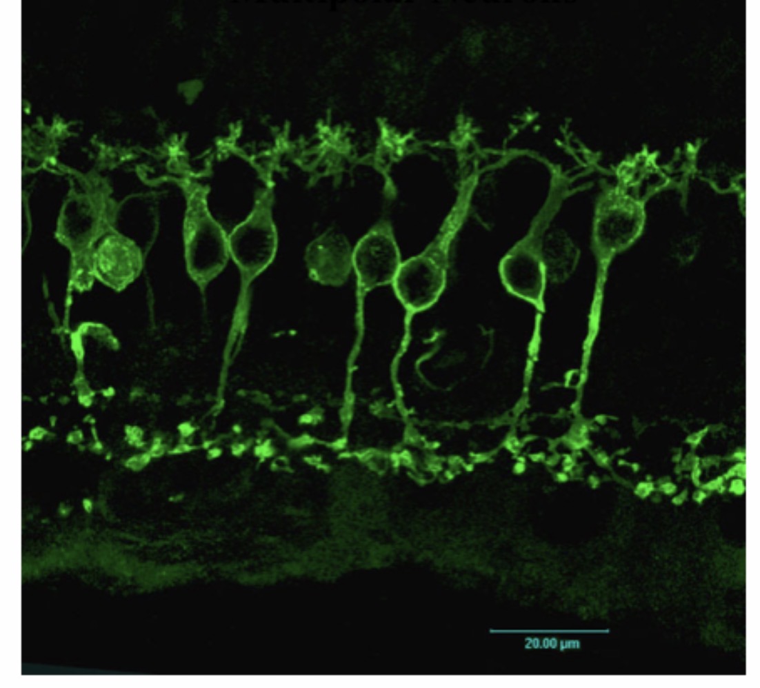 <p>Bipolar Neurons : Function : Carries sensory impulses for special senses like vision, smell, and hearing.</p>