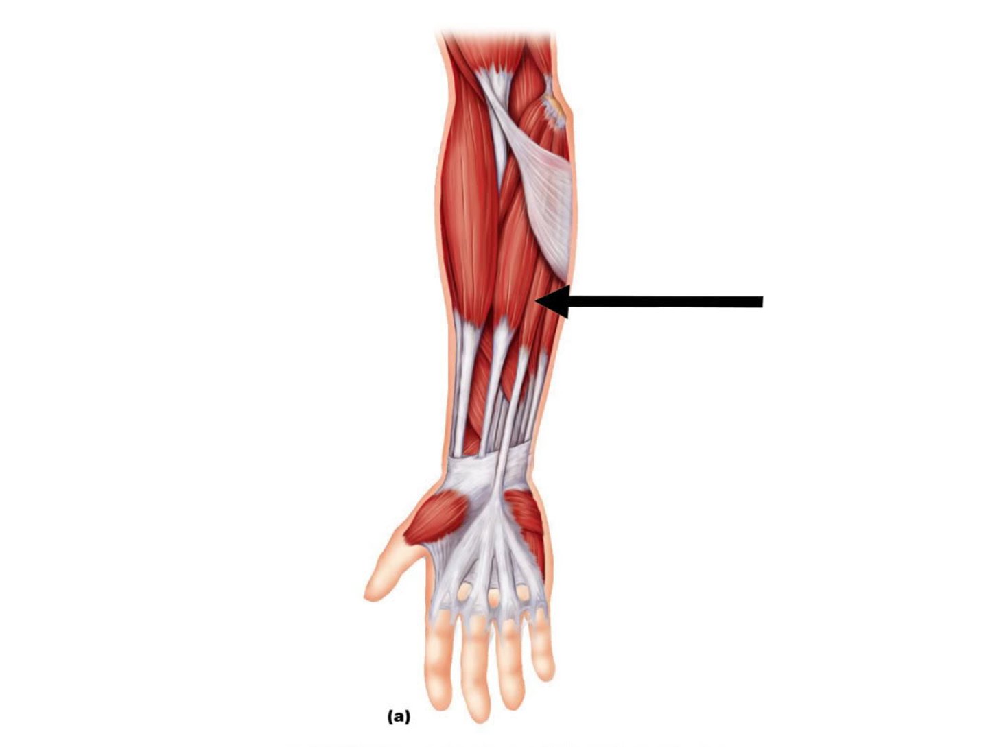 <p>Origin: Common flexor tendon.</p><p>Insertion: Palmar aponeurosis.</p><p>Innervation: Median nerve.</p><p>Action: Flexion of wrist.</p>