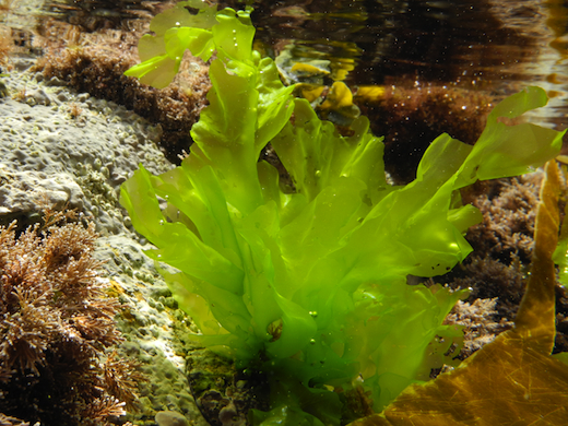 <p>Identify the genus of this Chlorophyta green algae.</p>