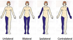 <p>contralateral</p>