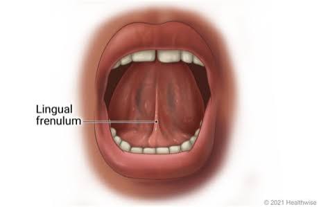 <p>frenulum lingae</p>