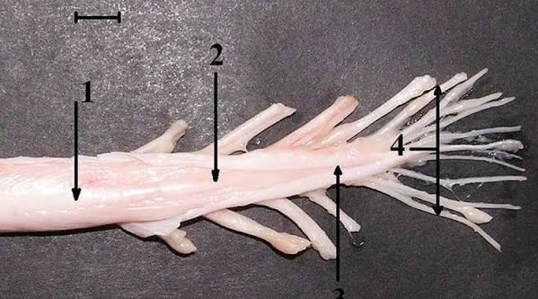 <p>What is the cauda equina?</p>