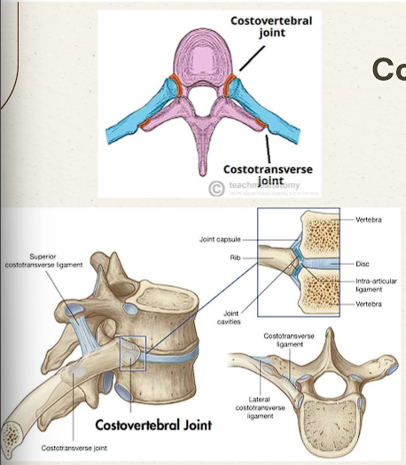 <p>Hinge joint attaching the head of the rib to the thoracic vertebral bodies</p><ul><li><p>Typical ribs 3-9 articulate </p><ul><li><p>Superior- attaches to vertebrae above</p></li><li><p>Inferior- attaches to its own vertebrae</p></li></ul></li><li><p>Rib 1, 10 (sometimes), 11 and 12 only articulate w/ inferior vertebrae</p></li></ul><p></p>
