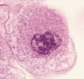 <p>what phase of the cell cycle is this?</p>