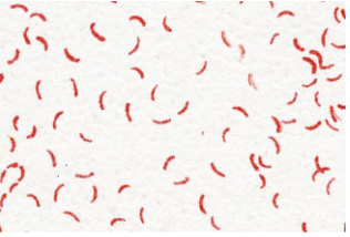 <p>what bacterial shape is this?</p>